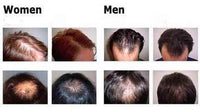 Load image into Gallery viewer, Organic Hair Growth Essence
